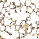 Immunohistochemistry - NFKB1 antibody from Signalway Antibody (39087) - Antibodies.com
