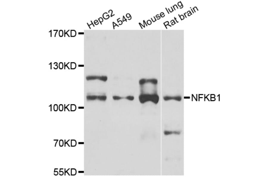 Western blot - NFKB1 antibody from Signalway Antibody (39087) - Antibodies.com