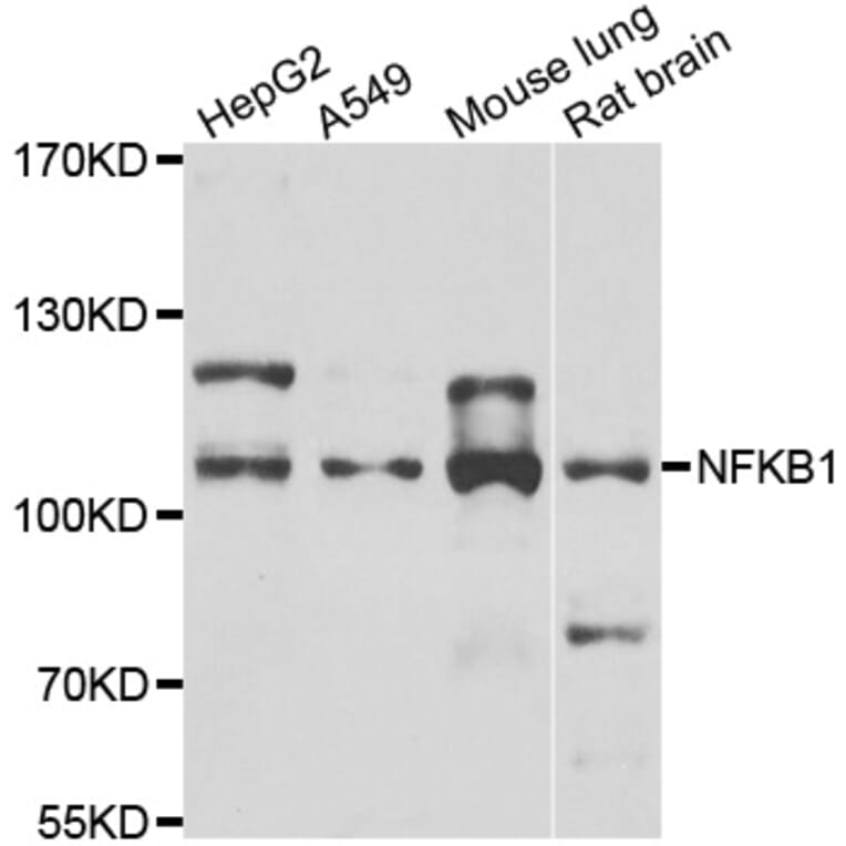 Western blot - NFKB1 antibody from Signalway Antibody (39087) - Antibodies.com