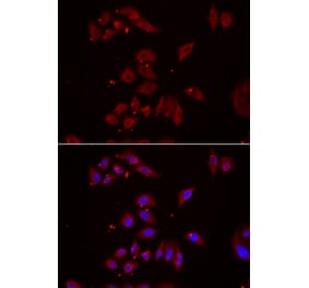 Immunofluorescence - NPHP1 antibody from Signalway Antibody (39091) - Antibodies.com