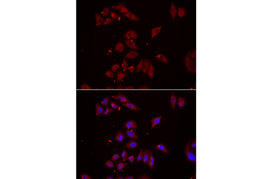 Immunofluorescence - NPHP1 antibody from Signalway Antibody (39091) - Antibodies.com