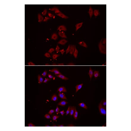 Immunofluorescence - NPHP1 antibody from Signalway Antibody (39091) - Antibodies.com