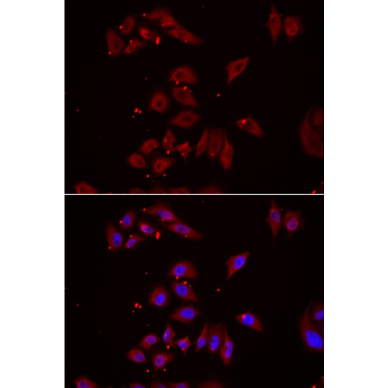 Immunofluorescence - NPHP1 antibody from Signalway Antibody (39091) - Antibodies.com
