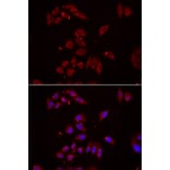 Immunofluorescence - NPHP1 antibody from Signalway Antibody (39091) - Antibodies.com