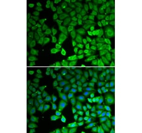 Immunofluorescence - NR4A1 antibody from Signalway Antibody (39092) - Antibodies.com
