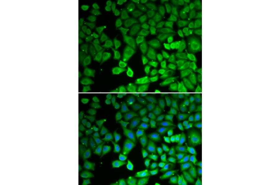 Immunofluorescence - NR4A1 antibody from Signalway Antibody (39092) - Antibodies.com