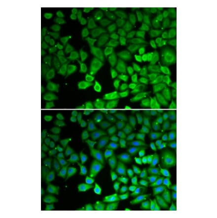 Immunofluorescence - NR4A1 antibody from Signalway Antibody (39092) - Antibodies.com