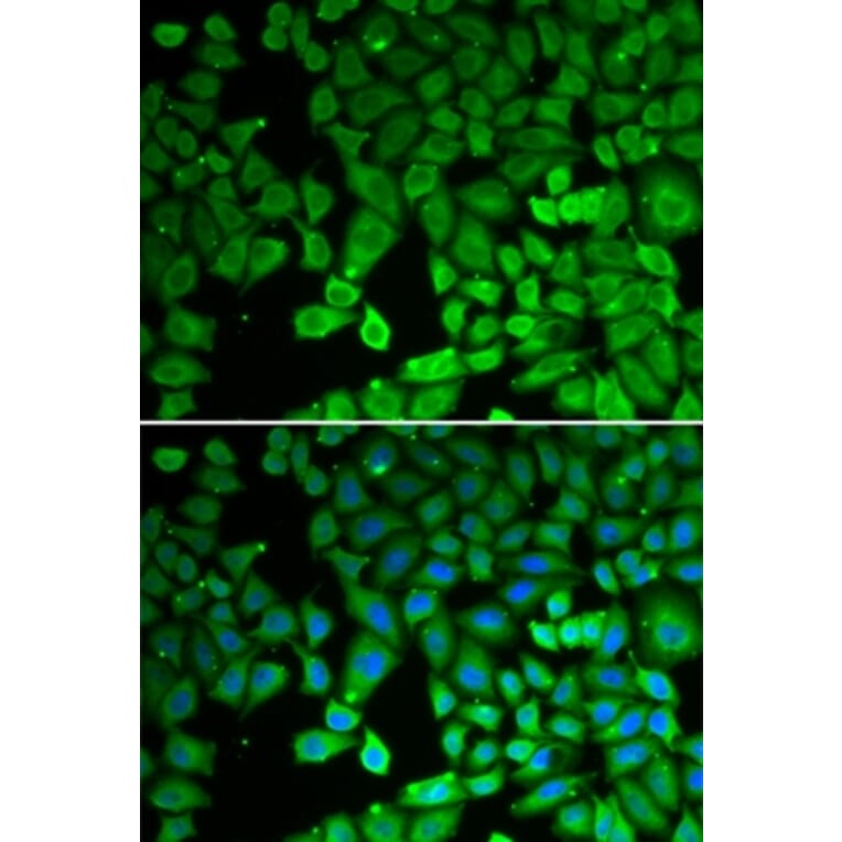 Immunofluorescence - NR4A1 antibody from Signalway Antibody (39092) - Antibodies.com