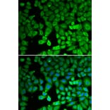 Immunofluorescence - NR4A1 antibody from Signalway Antibody (39092) - Antibodies.com