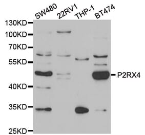 Western blot - P2RX4 antibody from Signalway Antibody (39096) - Antibodies.com