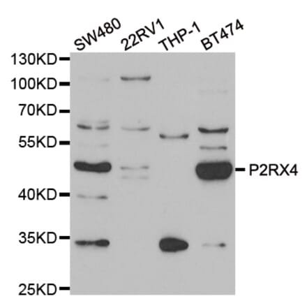 Western blot - P2RX4 antibody from Signalway Antibody (39096) - Antibodies.com