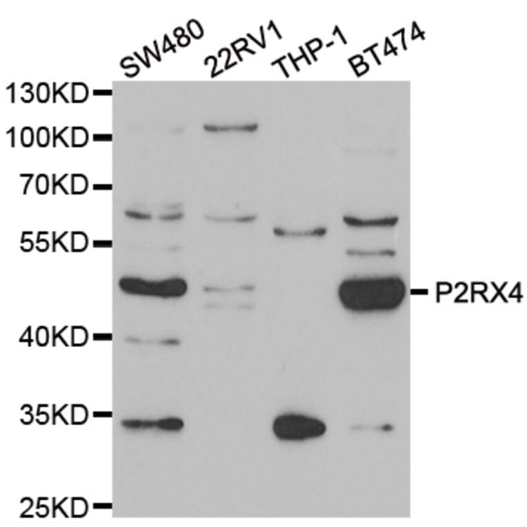 Western blot - P2RX4 antibody from Signalway Antibody (39096) - Antibodies.com