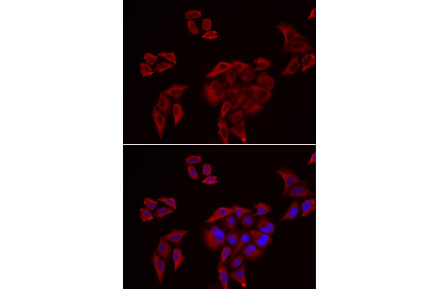 Immunofluorescence - P2RX4 antibody from Signalway Antibody (39096) - Antibodies.com