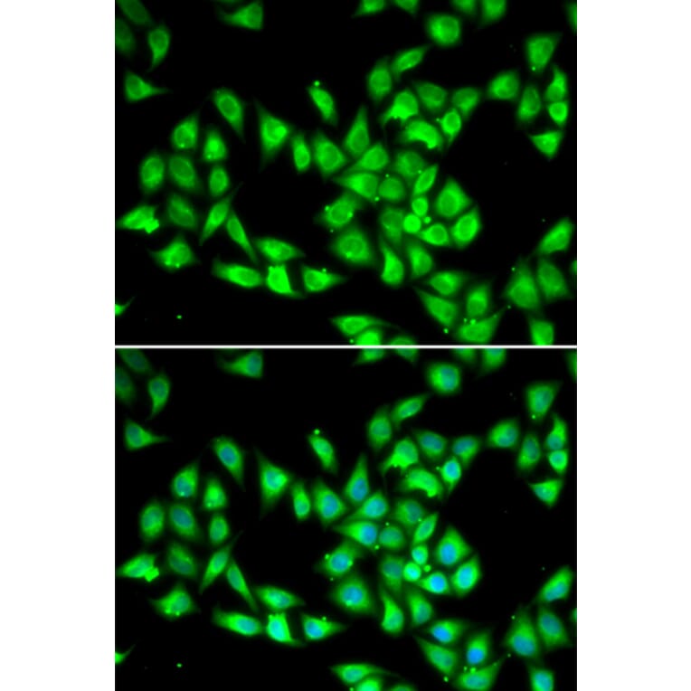 Immunofluorescence - PCMT1 antibody from Signalway Antibody (39098) - Antibodies.com