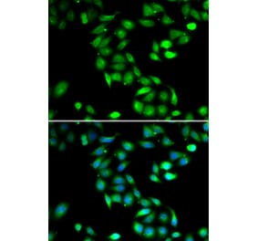 Immunofluorescence - PDCD6 antibody from Signalway Antibody (39099) - Antibodies.com