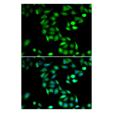 Immunofluorescence - PDCD6 antibody from Signalway Antibody (39099) - Antibodies.com