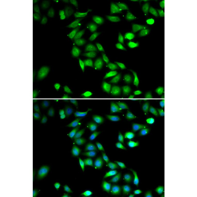 Immunofluorescence - PDCD6 antibody from Signalway Antibody (39099) - Antibodies.com