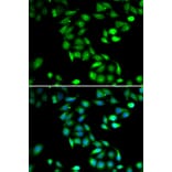 Immunofluorescence - PDCD6 antibody from Signalway Antibody (39099) - Antibodies.com