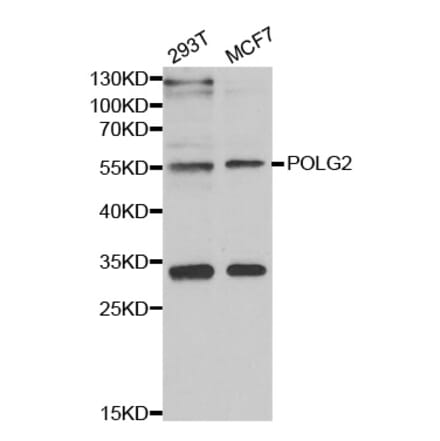 Western blot - POLG2 antibody from Signalway Antibody (39108) - Antibodies.com