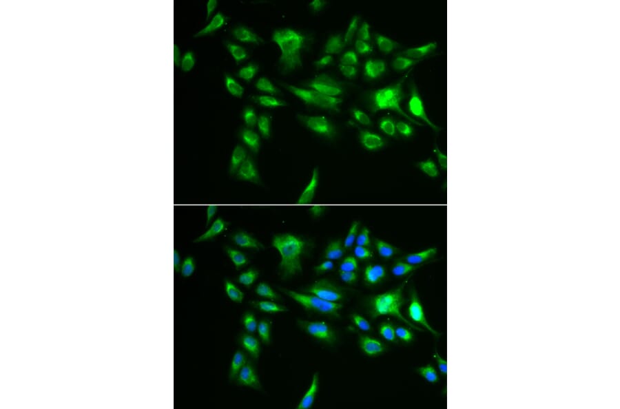 Immunofluorescence - POLG2 antibody from Signalway Antibody (39108) - Antibodies.com