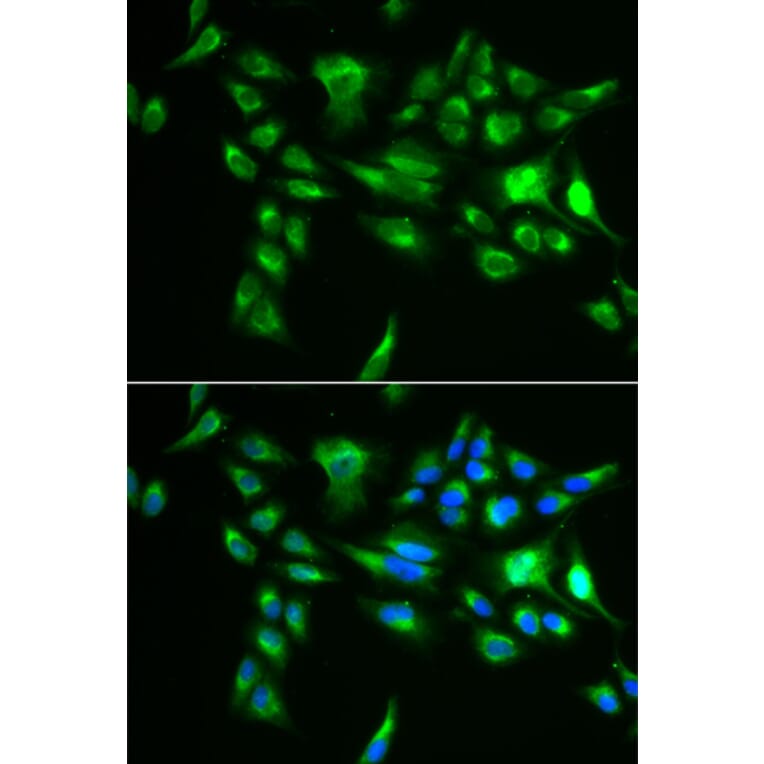 Immunofluorescence - POLG2 antibody from Signalway Antibody (39108) - Antibodies.com