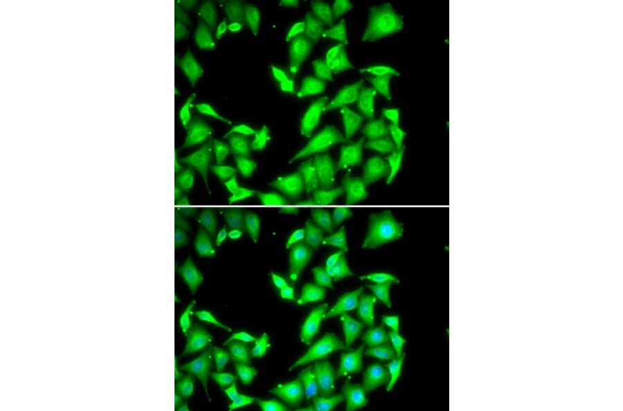Immunofluorescence - PPM1A antibody from Signalway Antibody (39112) - Antibodies.com