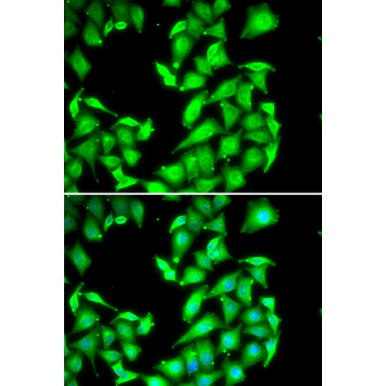 Immunofluorescence - PPM1A antibody from Signalway Antibody (39112) - Antibodies.com