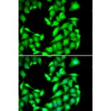 Immunofluorescence - PPM1A antibody from Signalway Antibody (39112) - Antibodies.com