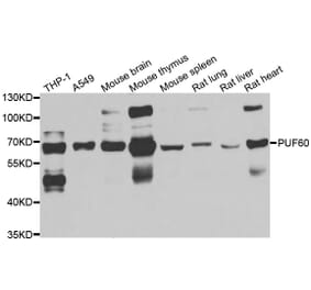 Western blot - PUF60 antibody from Signalway Antibody (39120) - Antibodies.com