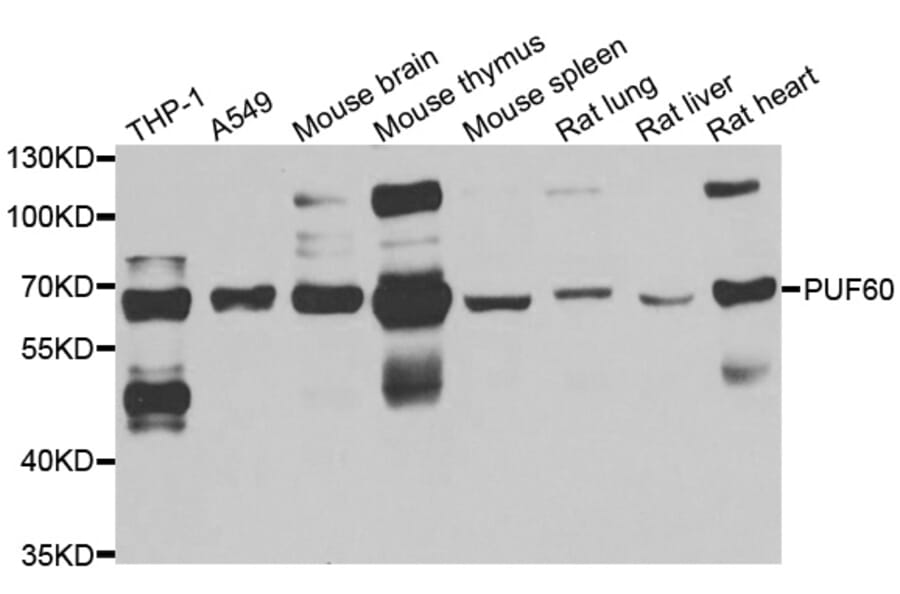 Western blot - PUF60 antibody from Signalway Antibody (39120) - Antibodies.com