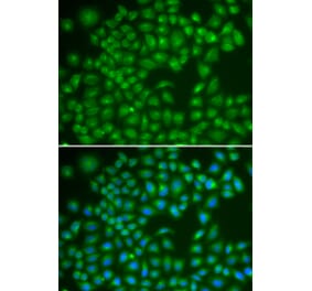 Immunofluorescence - RAB4A antibody from Signalway Antibody (39123) - Antibodies.com