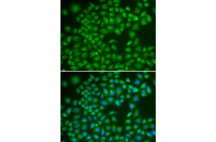 Immunofluorescence - RAB4A antibody from Signalway Antibody (39123) - Antibodies.com