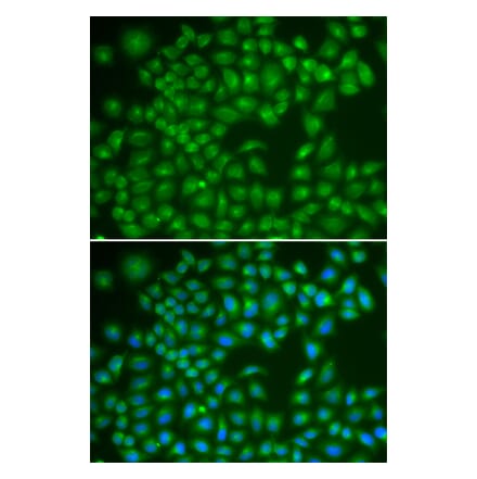 Immunofluorescence - RAB4A antibody from Signalway Antibody (39123) - Antibodies.com