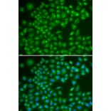 Immunofluorescence - RAB4A antibody from Signalway Antibody (39123) - Antibodies.com