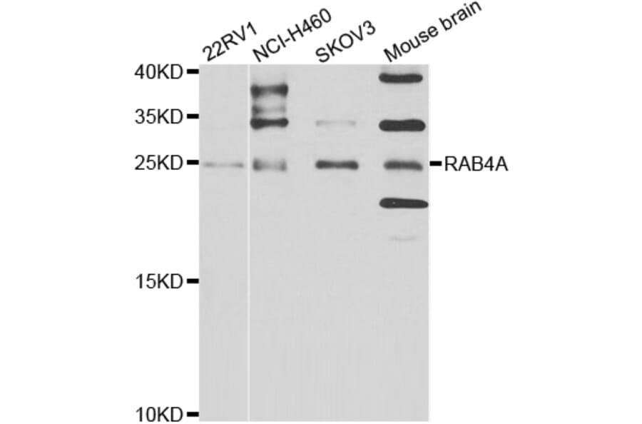 Western blot - RAB4A antibody from Signalway Antibody (39123) - Antibodies.com
