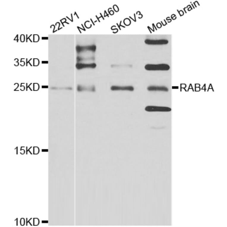 Western blot - RAB4A antibody from Signalway Antibody (39123) - Antibodies.com