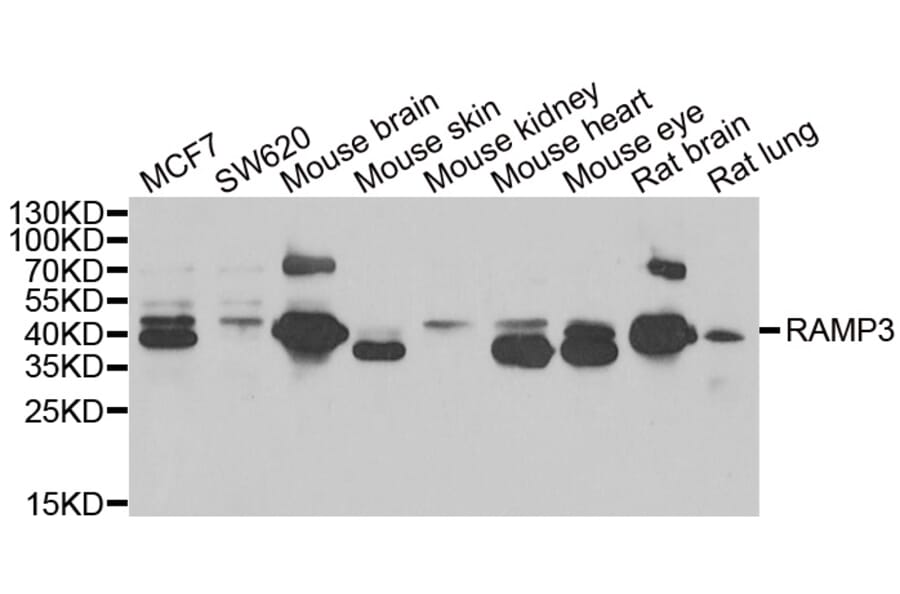 Western blot - RAMP3 antibody from Signalway Antibody (39126) - Antibodies.com