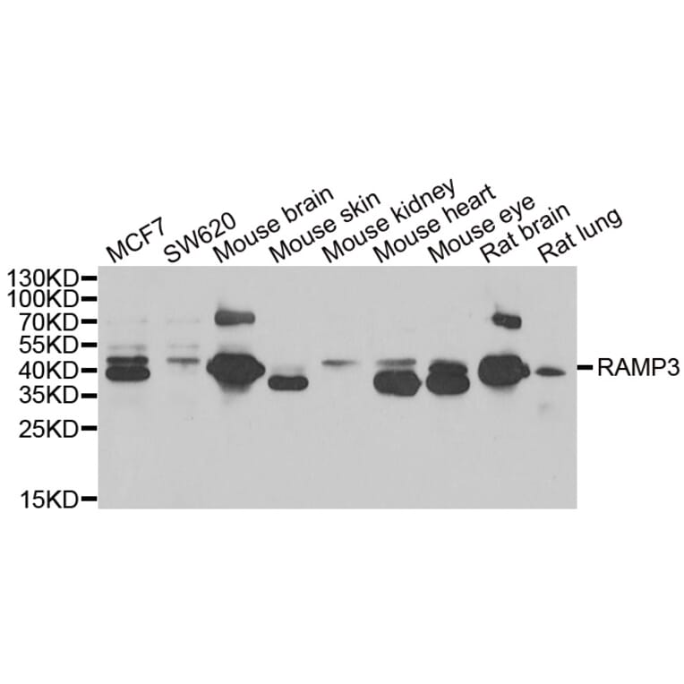 Western blot - RAMP3 antibody from Signalway Antibody (39126) - Antibodies.com