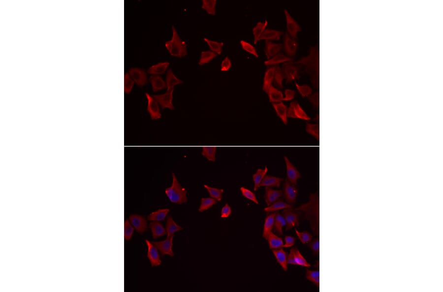 Immunofluorescence - RAMP3 antibody from Signalway Antibody (39126) - Antibodies.com