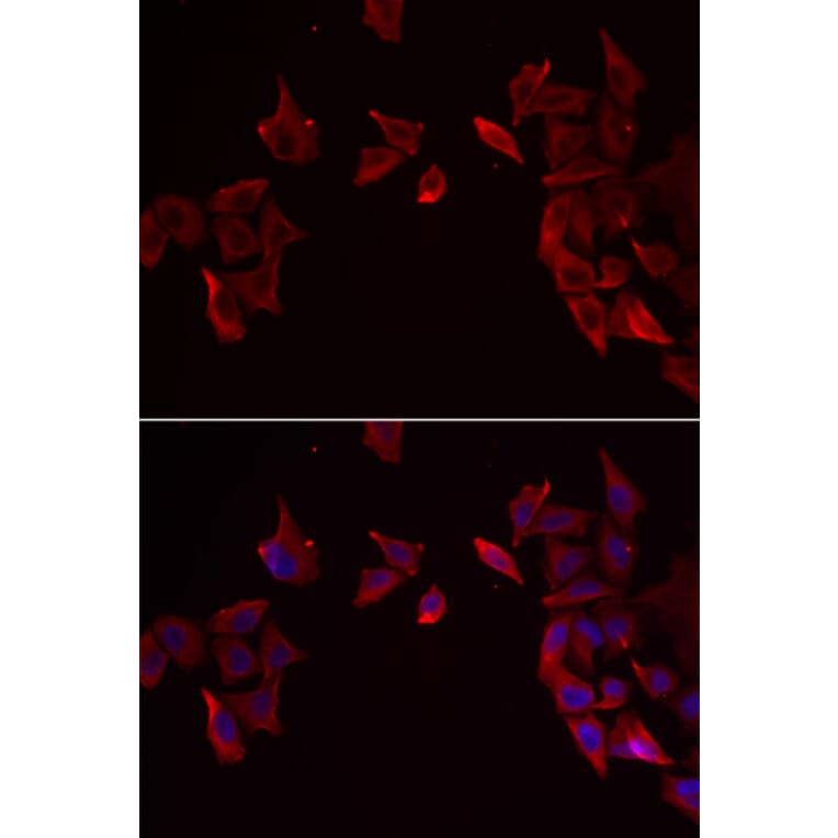 Immunofluorescence - RAMP3 antibody from Signalway Antibody (39126) - Antibodies.com