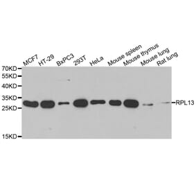 Western blot - RPL13 antibody from Signalway Antibody (39130) - Antibodies.com