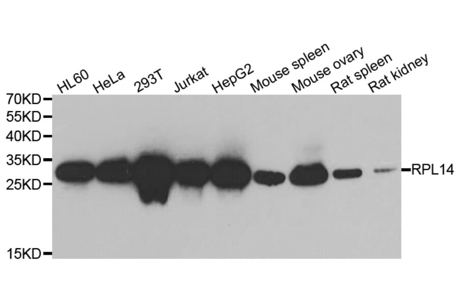 Western blot - RPL14 antibody from Signalway Antibody (39131) - Antibodies.com