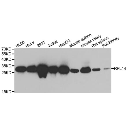 Western blot - RPL14 antibody from Signalway Antibody (39131) - Antibodies.com