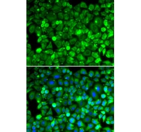 Immunofluorescence - RPLP1 antibody from Signalway Antibody (39132) - Antibodies.com