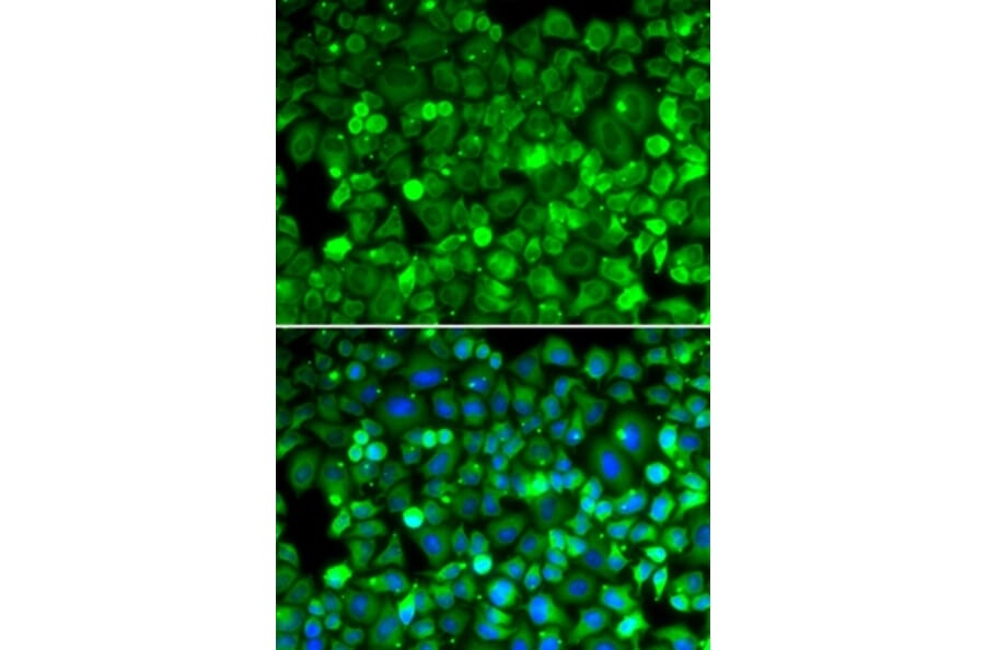 Immunofluorescence - RPLP1 antibody from Signalway Antibody (39132) - Antibodies.com