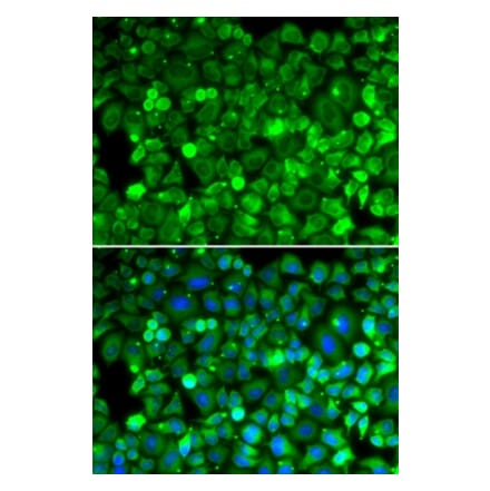 Immunofluorescence - RPLP1 antibody from Signalway Antibody (39132) - Antibodies.com