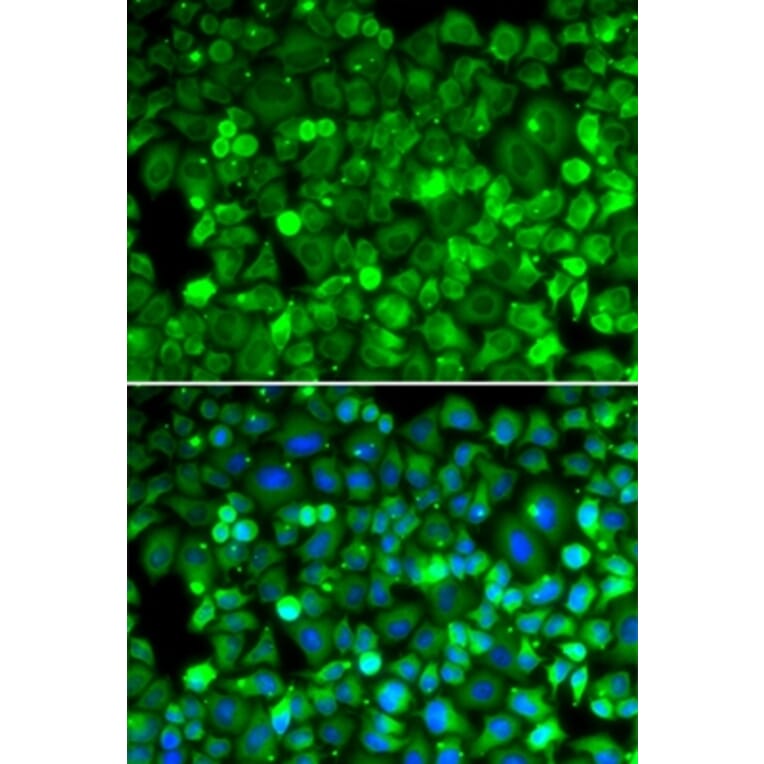 Immunofluorescence - RPLP1 antibody from Signalway Antibody (39132) - Antibodies.com