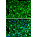 Immunofluorescence - RPLP1 antibody from Signalway Antibody (39132) - Antibodies.com
