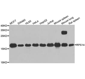 Western blot - RPS14 antibody from Signalway Antibody (39134) - Antibodies.com