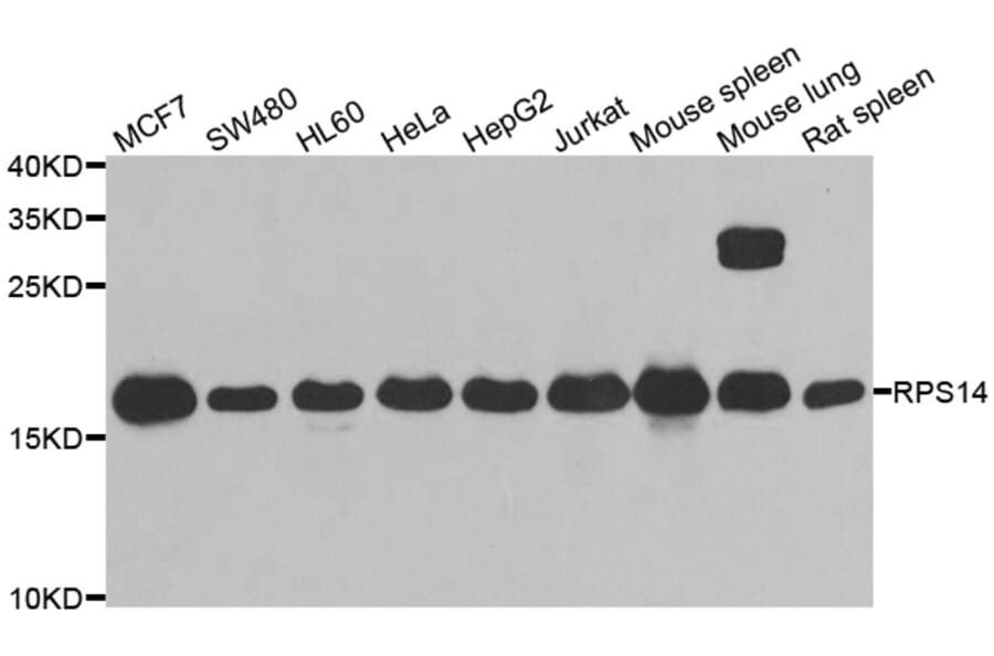 Western blot - RPS14 antibody from Signalway Antibody (39134) - Antibodies.com